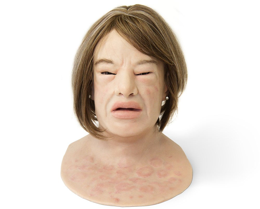 Erica Anaphylaxis SimMan Facial Overlay