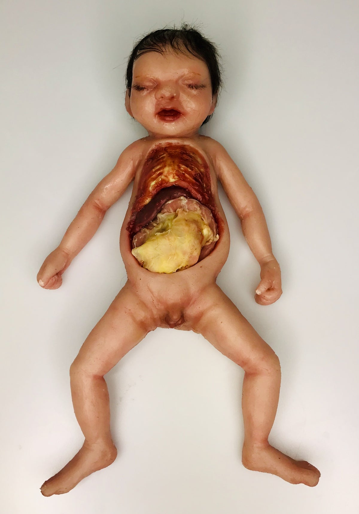 MO802 Baby Patrick -Preemie - Surgical Nec Training
