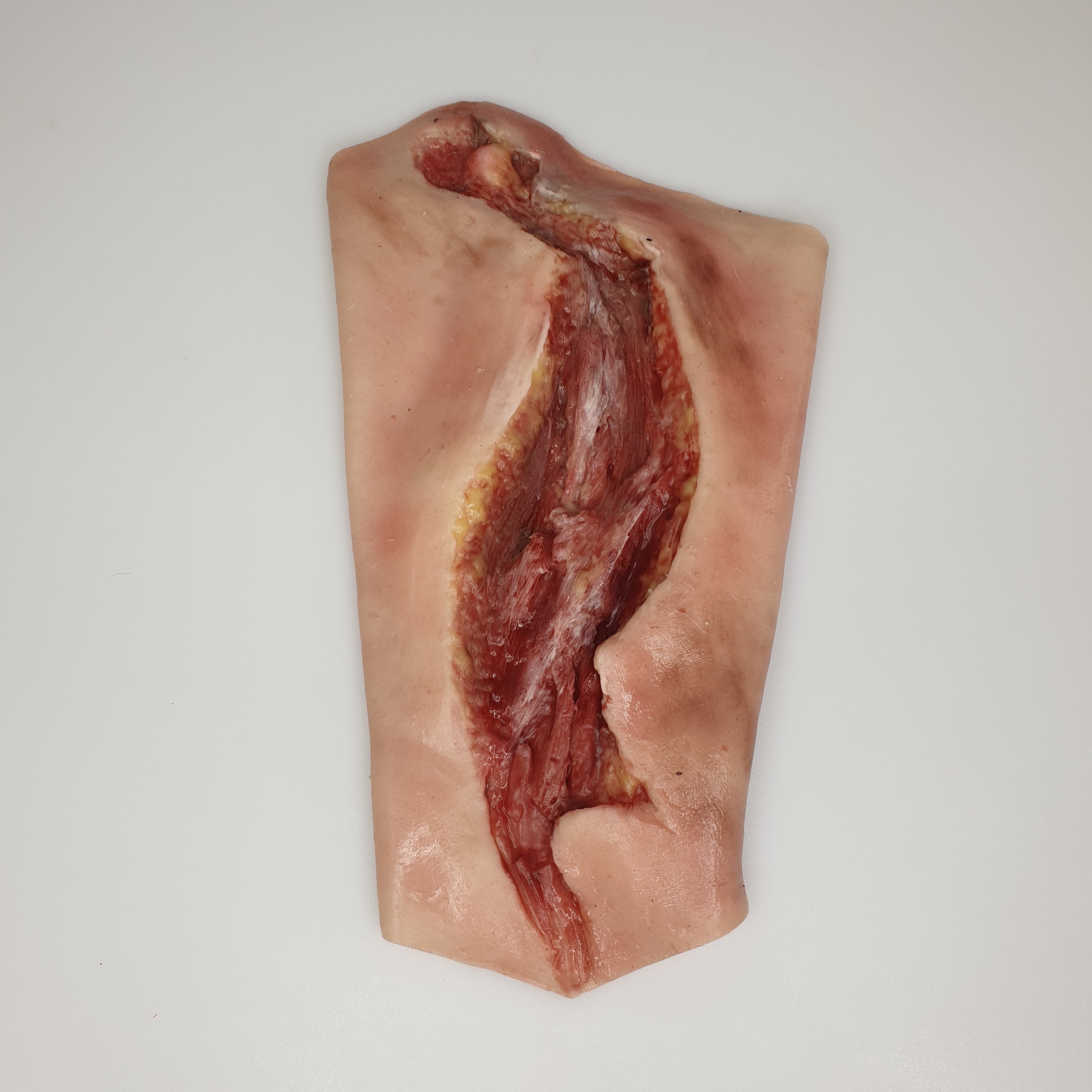 SKILLS - Pre-hospital work injuries package