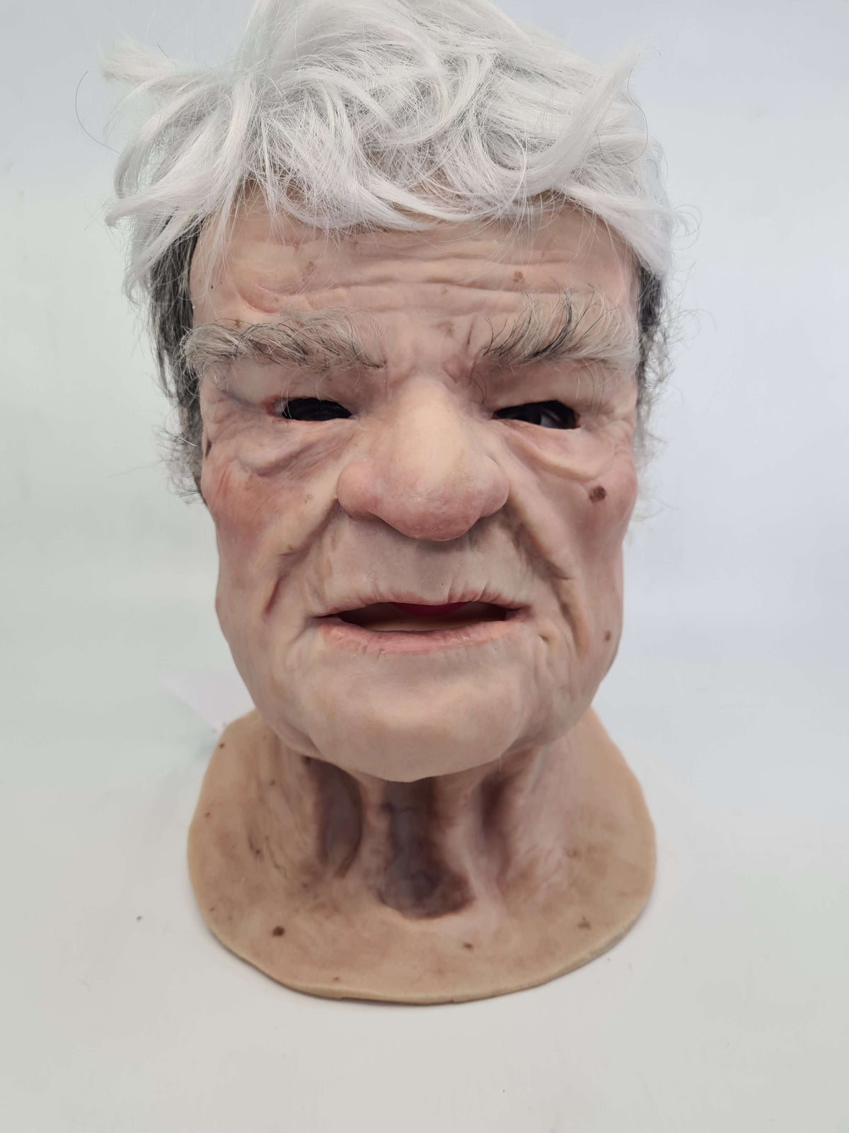 Murray- ALS Facial Overlay