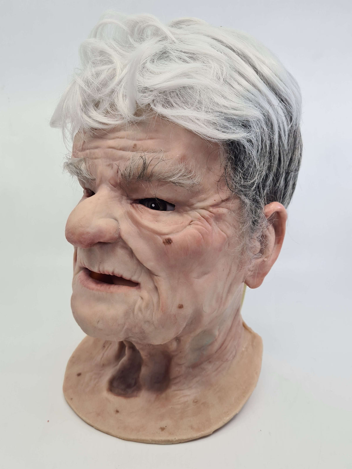 Murray- ALS Facial Overlay