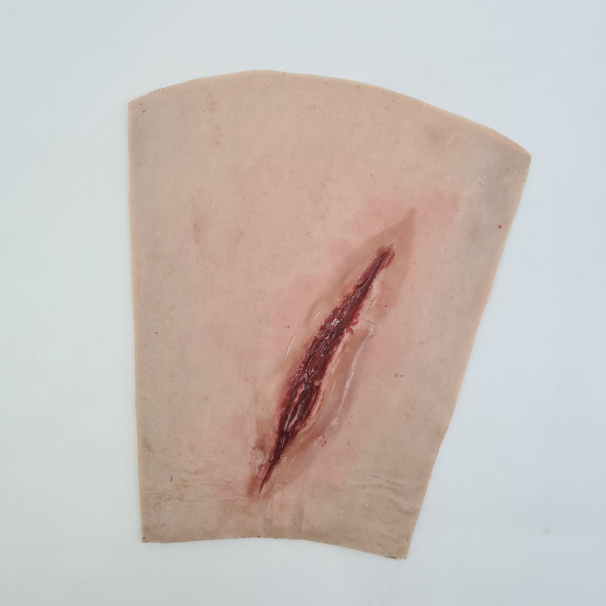 MT046 Suture Wrist laceration