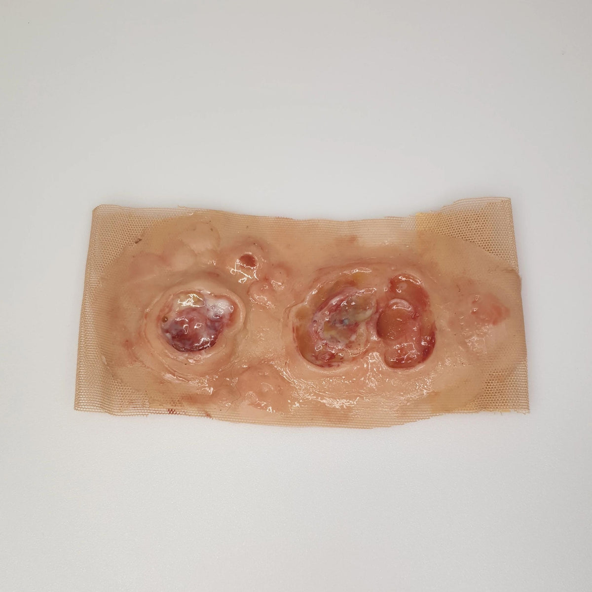 SKILLS - Skin and wound care tissue viability package