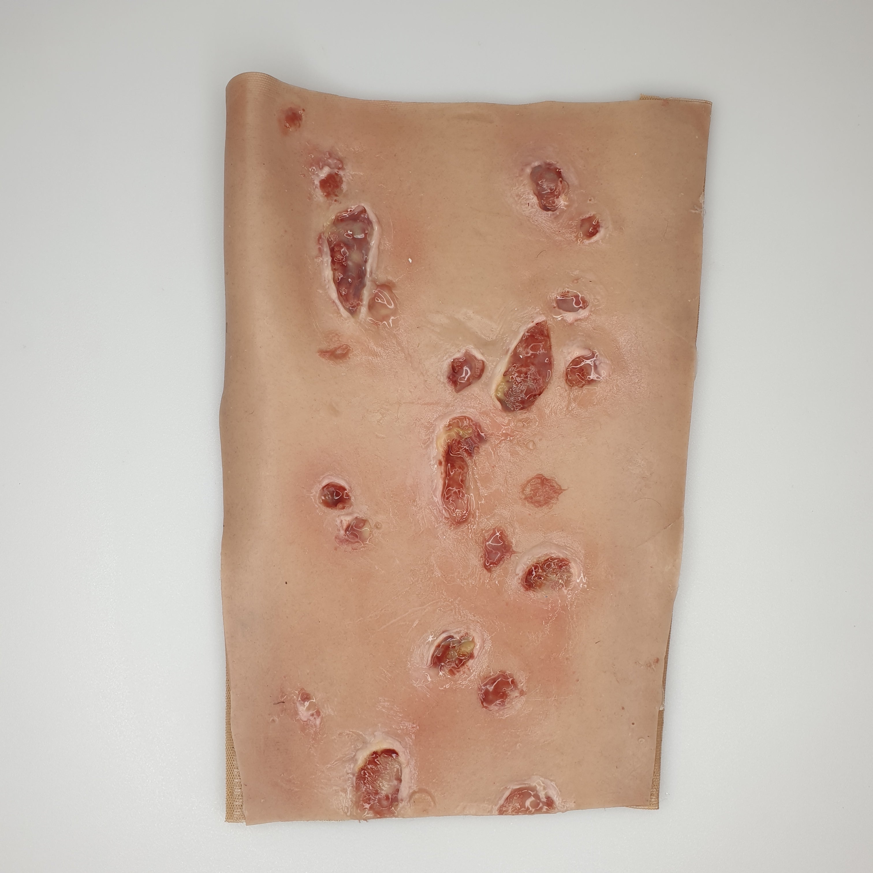 SKILLS - Skin and wound care tissue viability package